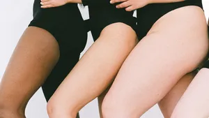 Het vet dat je niet ziet blijkt meer met je hersenen te doen dan gedacht