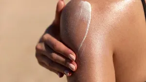 Vrouw smeert zonnebrandcrème op haar huid in de zon, klaar voor de zomer.