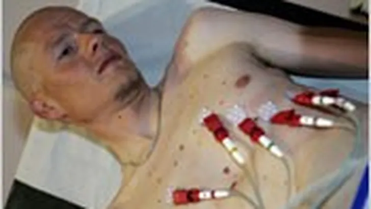 Renners eisen meer respect