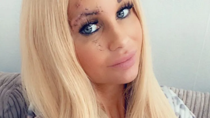 De blondine is nog geen 10 weken in verwachting
