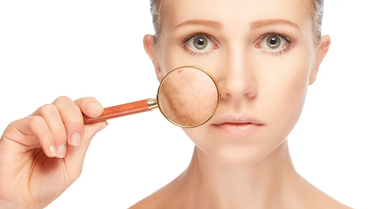 De huidverzorgingsfout die je maakt waar je acne van krijgt