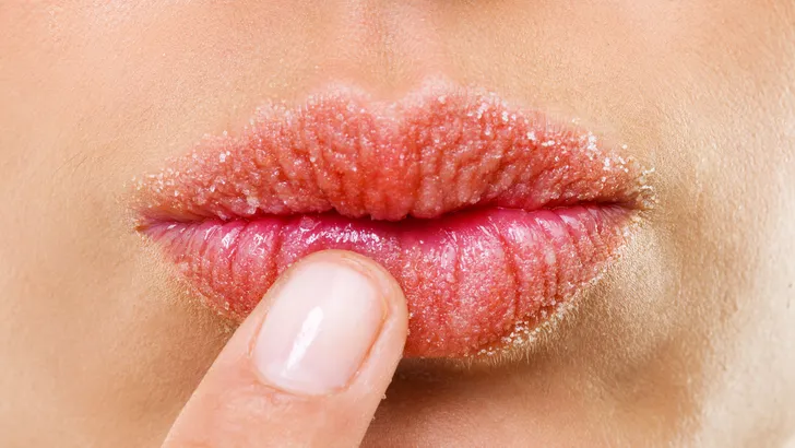 Dít dagelijkse product is de oorzaak van je droge lippen