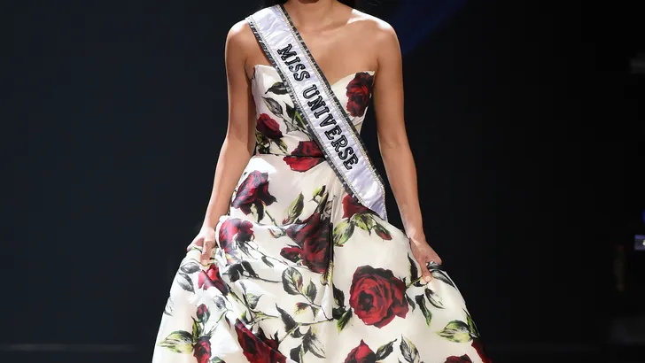 Prachtig: meisje vol moedervlekken doet auditie voor Miss Universe