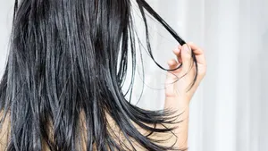 Vrouw met vettig haar.