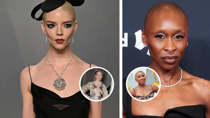 De nieuwste obsessie in Hollywood heet buccal fat removal. Wie deden het, wat houdt het in en waarom is de ingreep zo populair? Je leest het hier.