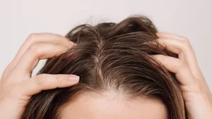 Snel vet haar? Dít is het wasadvies van een dermatoloog