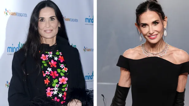 Celebrities en buccal fat removal before en after: Demi Moore.