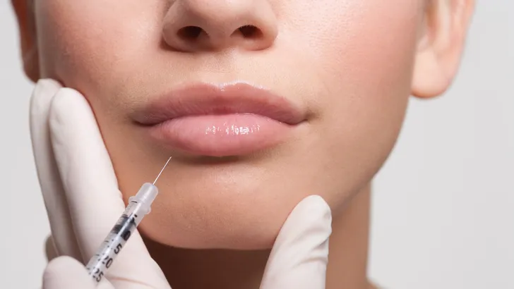 Beautytrend in Azië: De lipverkleining