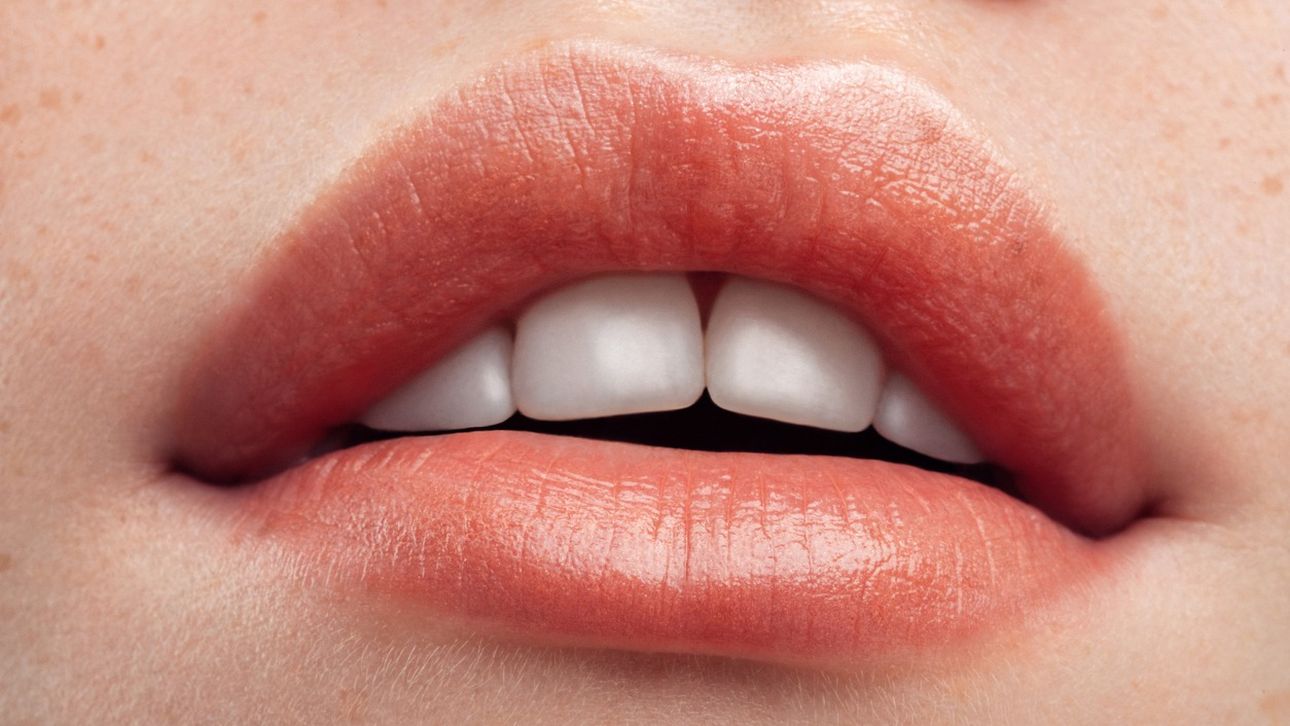 Je Lippen Vertellen Meer Over Je Gezondheid Dan Je Denkt Marie Claire