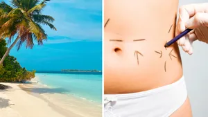 Tweeluik foto's: Links een tropisch strand, rechts een close-up van een taille met markeringen voor cosmetische ingrepen.
