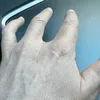 Oud-renner Tom Danielson had een handtumor en liet vinger amputeren: 'Elke scan maakt me bang' | Wieler Revue