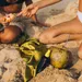 Zonnebrand op het strand
