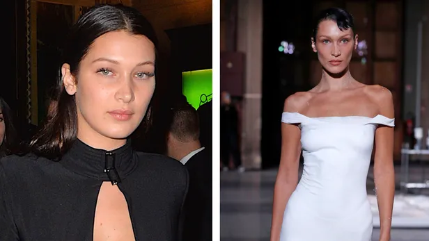 Celebrities en buccal fat removal before en after: Bella Hadid.