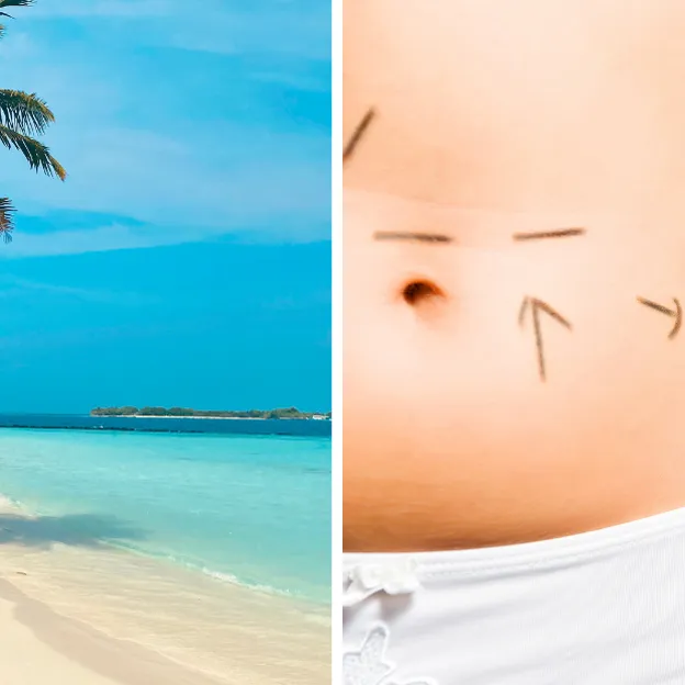 Tweeluik foto's: Links een tropisch strand, rechts een close-up van een taille met markeringen voor cosmetische ingrepen.