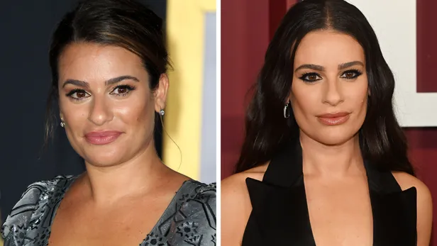 Celebrities en buccal fat removal before en after: Lea Michele.