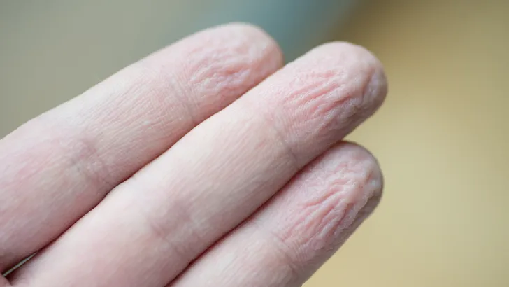 Waarom je rimpelige vingers krijgt als je in bad zit