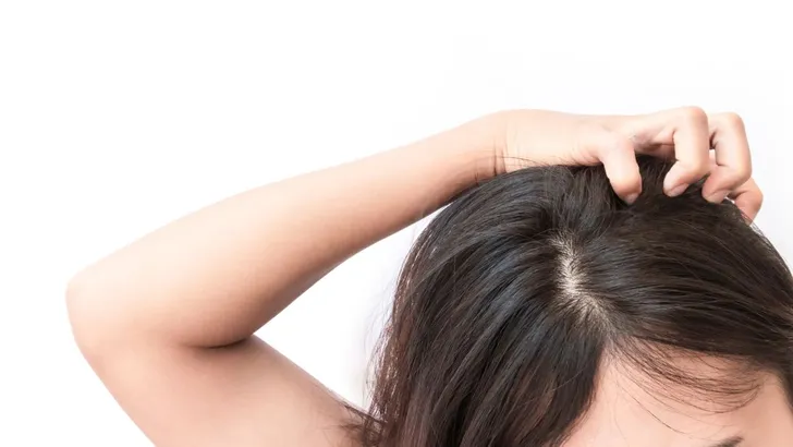 Vrouw heeft jeuk aan haar hoofdhuid.