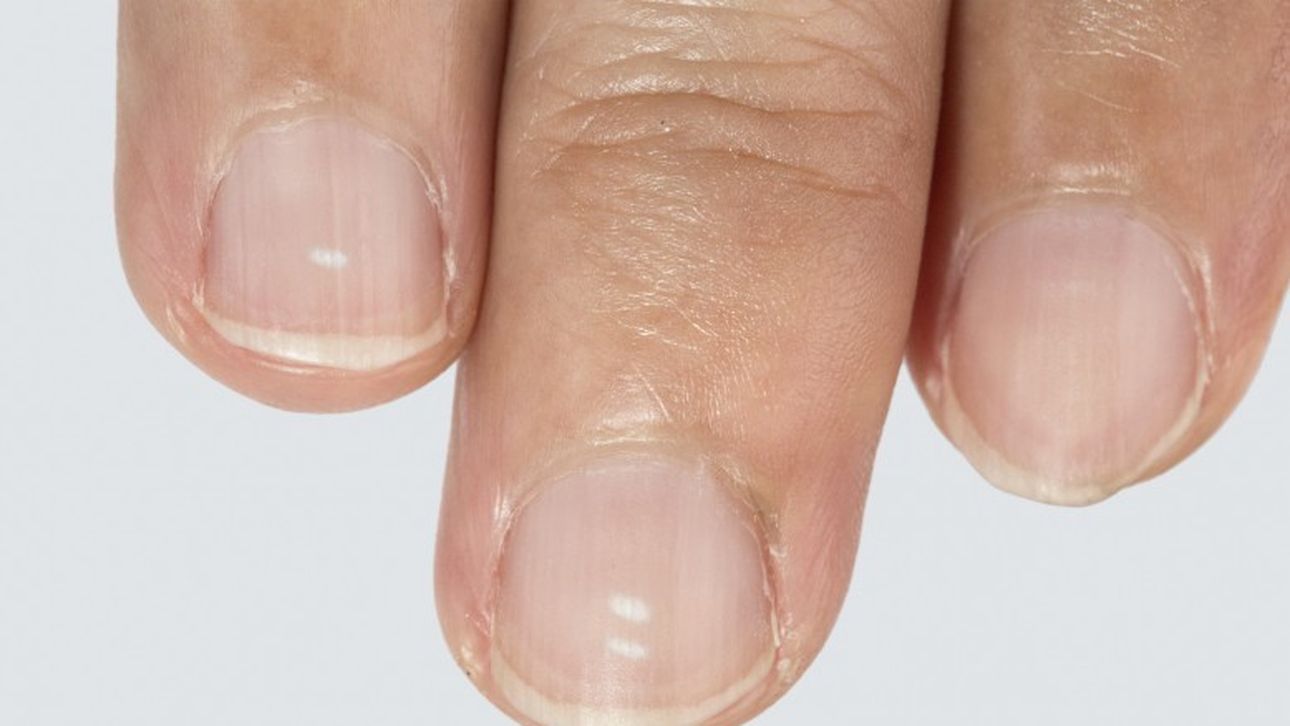 Wat de witte vlekjes op je nagels betekenen | Beau Monde