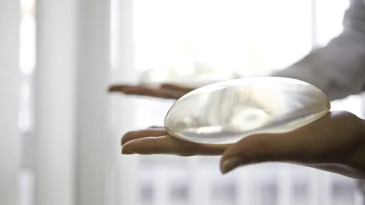 Borstimplantaten worden zelden verwijderd vanwege gezondheidsklachten