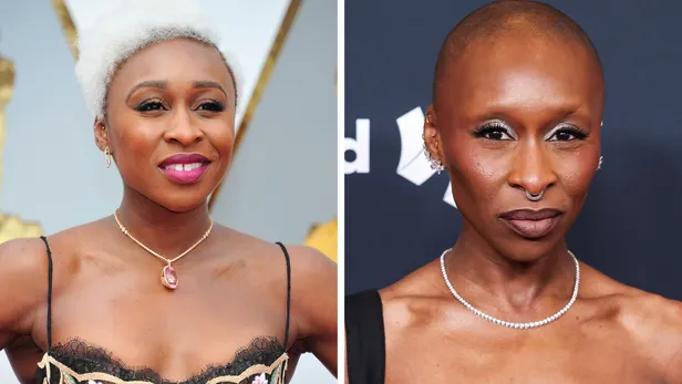 Celebrities en buccal fat removal before en after: Cynthia Erivo