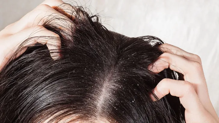 Vrouw heeft roos in haar haar.