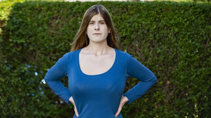 Vrouw zamelt geld in om haar enorme borsten te verkleinen
