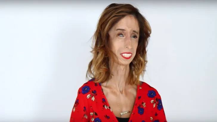 'Lelijkste vrouw ter wereld' deelt haar visie op beauty