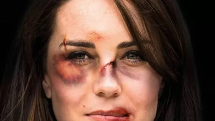 Hertogin Kate in shockcampagne tegen huiselijk geweld
