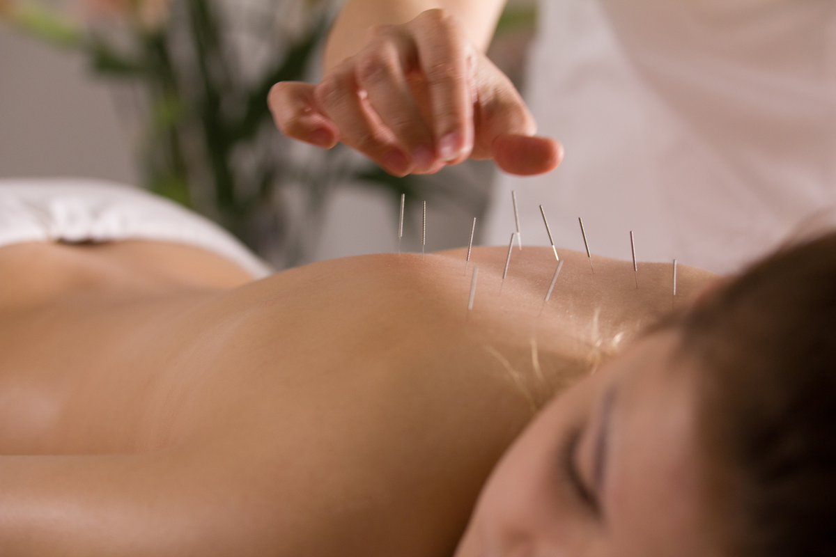 Gezonde balans en gewichtsbeheersing met acupunctuur