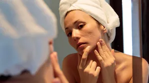 young woman looking her acne scars on the mirror