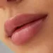 Vrouw met lipfillers.