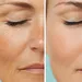 anti-aging