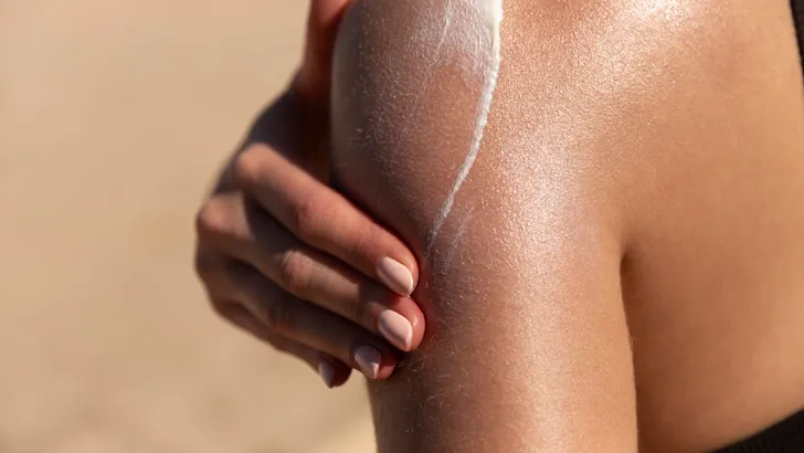 Smeren tegen strawberry skin: waarom je de Glycolic Acid Toner van The Ordinary moet combineren met ureum