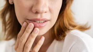 kapotte lippen