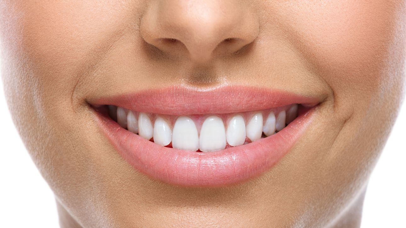 Dit betekenen de witte vlekjes op je tanden Happy in Shape