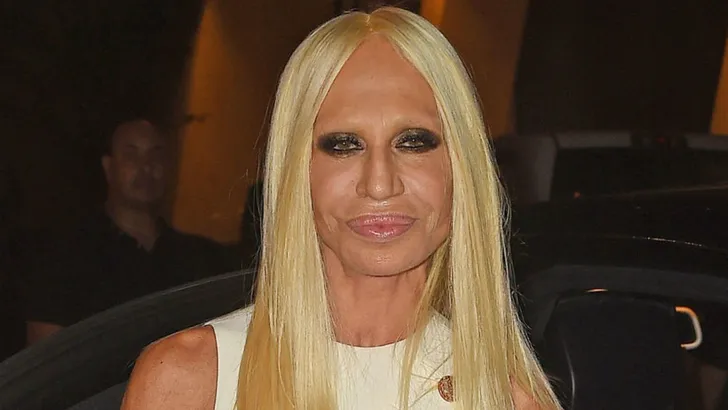 Oei: de plastisch chirurg heeft deze celebrity's geen goed gedaan