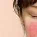 De meestgestelde vragen over rosacea – en antwoorden van een expert
