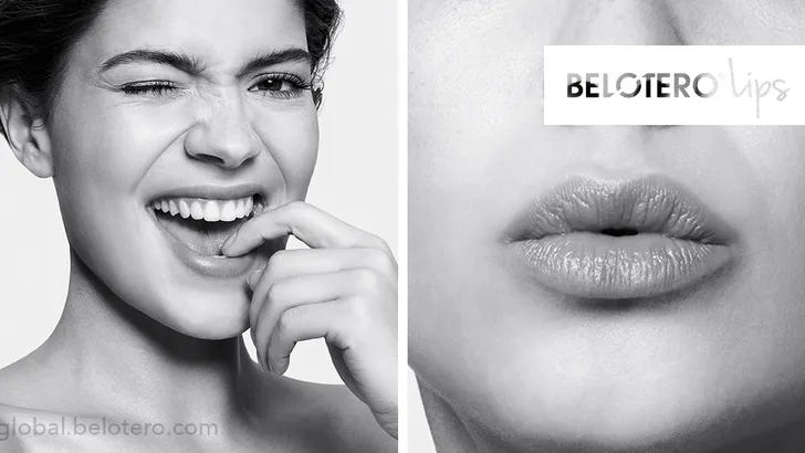 Deze nieuwe filler geeft de lippen weer een mooie volle, natuurlijke look