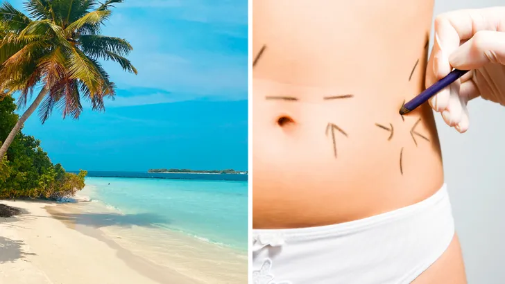 Tweeluik foto's: Links een tropisch strand, rechts een close-up van een taille met markeringen voor cosmetische ingrepen.