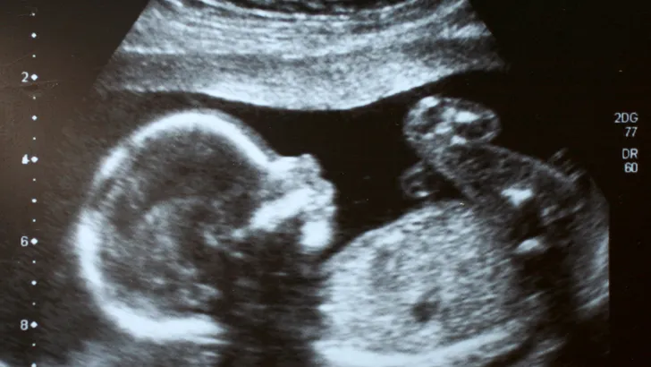 Een miskraam, een abortus, een leeg IVF-mandje: waarom pril verlies ertoe doet - en hoe je ermee omgaat