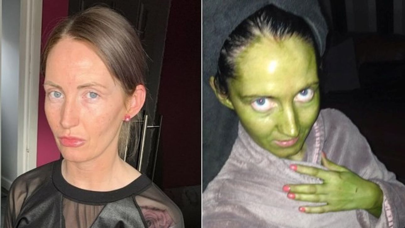 Vrouw Gebruikt Zelfbruiner Maar Dat Gaat Helemaal Fout Panorama