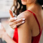 Close up of woman applying moisturizer on sunburned skin