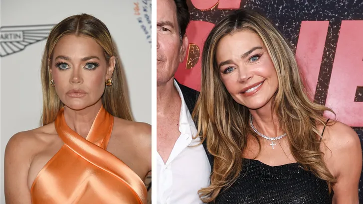 Denise Richards speelt open kaart. De actrice is eerlijk over haar 'nieuwe' gezicht en onthult dat zij niet de enige is in Beverly Hills.