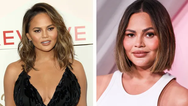 Celebrities en buccal fat removal before en after: Chrissy Teigen.