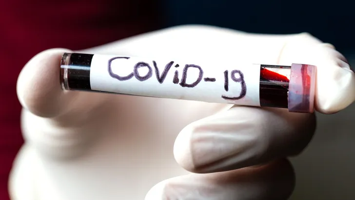 Aantal coronapatiënten op de IC wederom gedaald