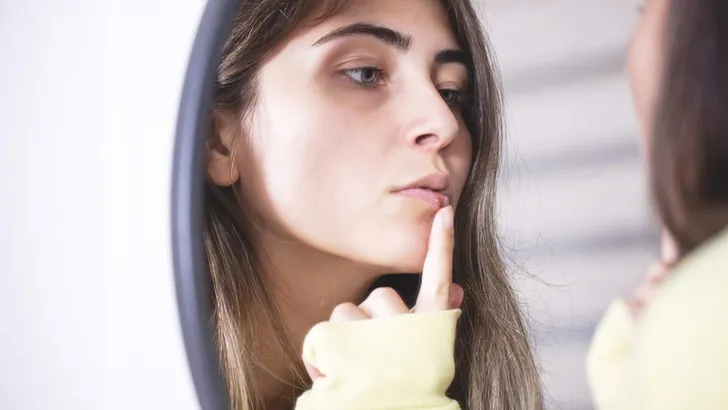 Woman applying cold sore cream on lips in front of mirror