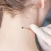 Fibroom: wat is het en wat kan je ertegen doen?