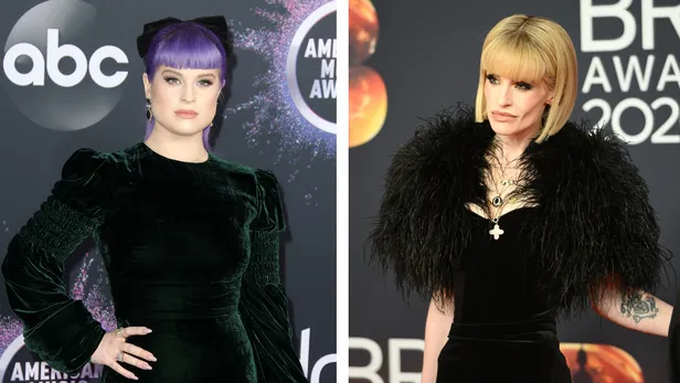 Celebrities en buccal fat removal before en after: Kelly Osbourne.