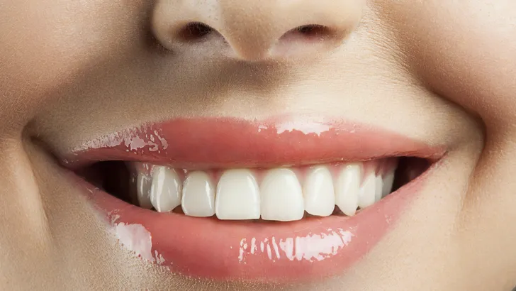 Dit doet tanderosie met je gezondheid