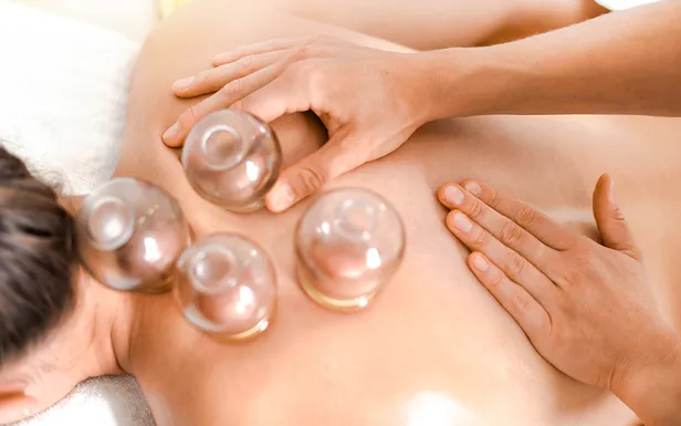 Cupping wordt als wonderbehandeling verkocht op sociale media